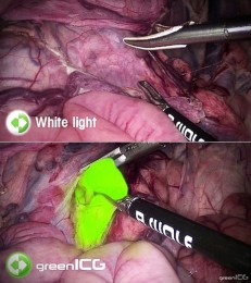 Foto: Bojnická nemocnica má novú endoskopicko-laparoskopickú zostavu najnovšej generácie. NAJMODERNEJŠIA TECHNIKA NIELEN PRE GYNEKOLOGICKÉ OPERÁCIE 0