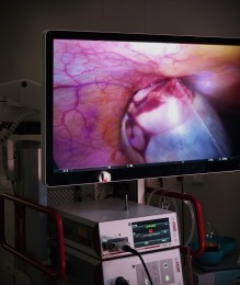 Foto: Bojnická nemocnica má novú endoskopicko-laparoskopickú zostavu najnovšej generácie. NAJMODERNEJŠIA TECHNIKA NIELEN PRE GYNEKOLOGICKÉ OPERÁCIE 1