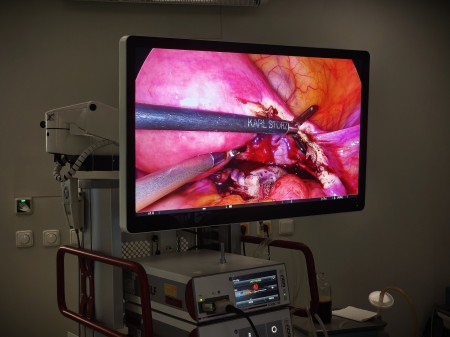 Foto: Bojnická nemocnica má novú endoskopicko-laparoskopickú zostavu najnovšej generácie. NAJMODERNEJŠIA TECHNIKA NIELEN PRE GYNEKOLOGICKÉ OPERÁCIE 2