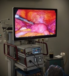 Foto: Bojnická nemocnica má novú endoskopicko-laparoskopickú zostavu najnovšej generácie. NAJMODERNEJŠIA TECHNIKA NIELEN PRE GYNEKOLOGICKÉ OPERÁCIE 3