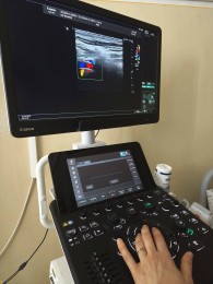 Foto: Bojnická nemocnica má na neurologickom oddelení nový ultrazvuk 0