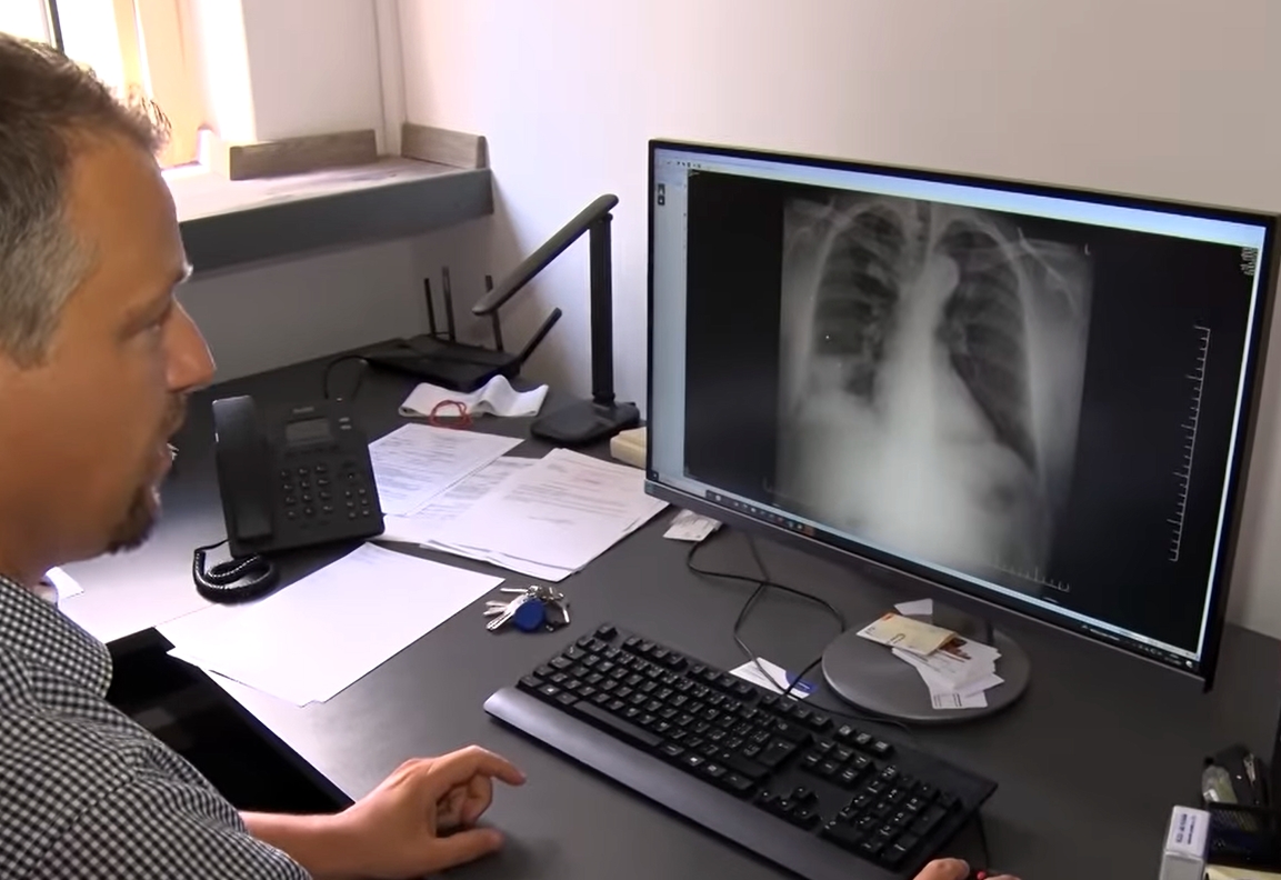 Video: Tajomný zápal pľúc v Ráztočne (okres Prievidza) sa preniesol zo zvierat na ľudí. SAV: V obci Ráztočno sa potvrdil výskyt Q horúčky